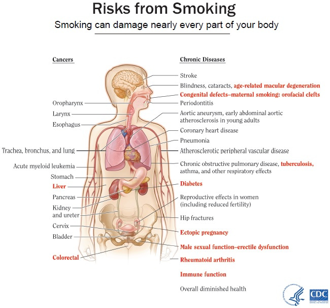 Smoking Risk image